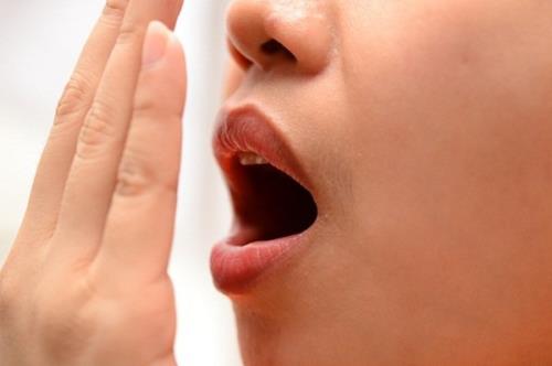 Hội miệng là 1 triệu chứng của viêm amidan mốc mủ