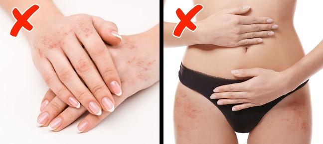 8 dau hieu cho thay co the ban can duoc bo sung VITAMIN