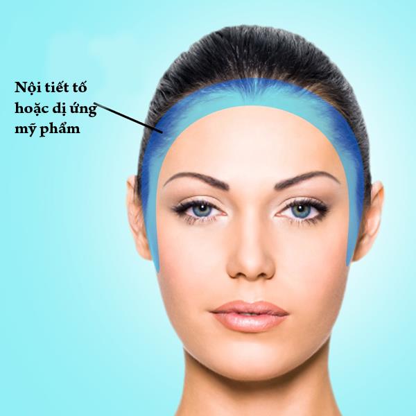 6 vi tri mun tren mat tiet lo cac van de suc khoe ban dang gap phai