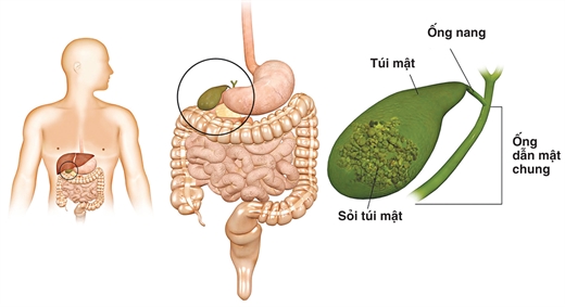 Loi ich khi dung gung tuoi thuong xuyen ban phai biet