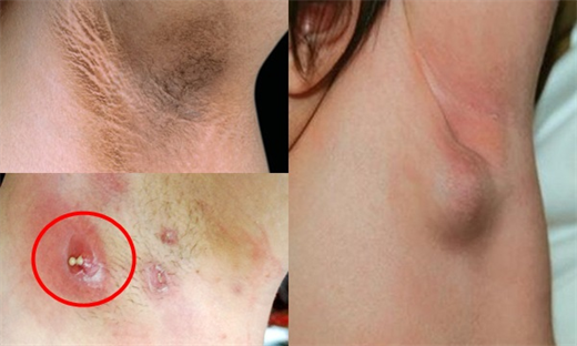 Khong phai do co dia, neu giu thoi quen nay cung se khien nach tham den, boc mui