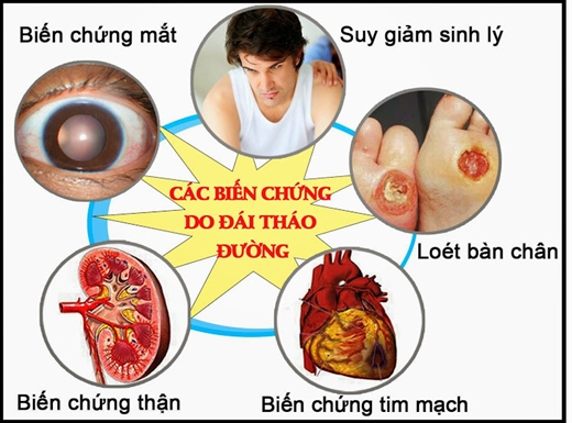 Khat nuoc lien tuc - dau hieu canh bao benh dai thao duong