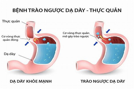 90% người không biết những căn bệnh nguy hiểm ẩn nấp đằng sau việc chảy nước dãi khi ngủ 90% nguoi khong biet nhung can benh nguy hiem an nap dang sau viec chay nuoc dai khi ngu