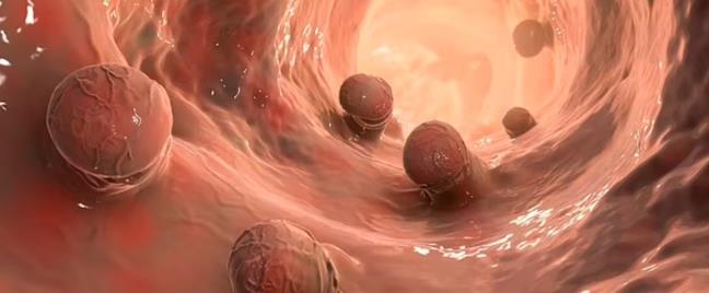 Thu nghiem thuoc chua ung thu tren 18 nguoi, 100% khoi benh, du di can o giai doan 2 va 3