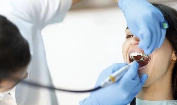 Lay cao rang co lam ton thuong rang khong? 5 nhom nguoi nay khong nen lay cao rang