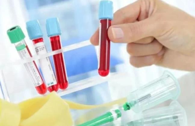 Khi xet nghiem mau dinh ky, neu 3 chi so nay tang cao can canh giac va nen kiem tra them