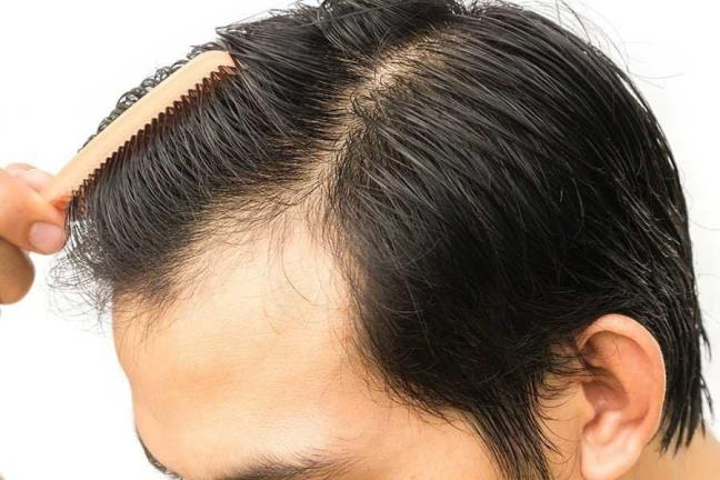 Dau hieu tren ngon tay chi ra ban co kha nang bi hoi cao gap 6 lan