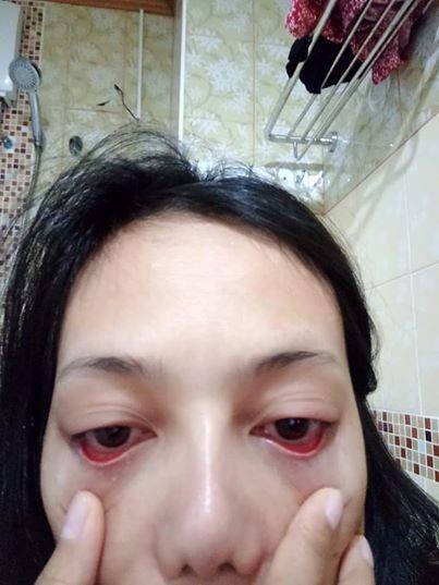 Noi mi co lam ton thuong mat khong, su that duoc tiet lo