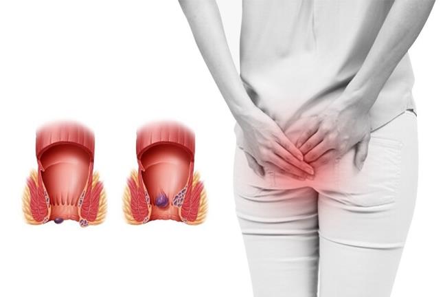 Neu 3 hien tuong bat thuong nay xay ra thuong xuyen thi co the da chuyen thanh ung thu ruot ket