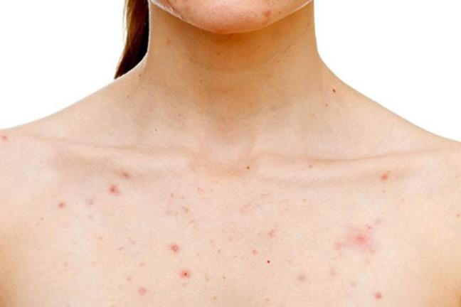 Tam nang vao mua xuan co the ngan ngua 3 benh, nhung co 2 nhom nguoi nen tranh tam nang