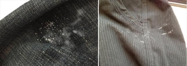 5 loi thuong gap khi giat do co the khien ca nha mac benh ngoai da, ban mac bao nhieu loi?