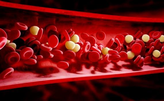 Thuc hien 6 dieu nay thuong xuyen, mach mau tron tru, khong lo mang bam