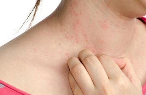 Hay cam thay ngua vao mua dong, co the do thieu hut 3 chat dinh duong nay