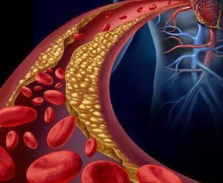 Uong ca phe giup giam nguy co tu vong, dac biet phu hop voi 4 nhom nguoi nay