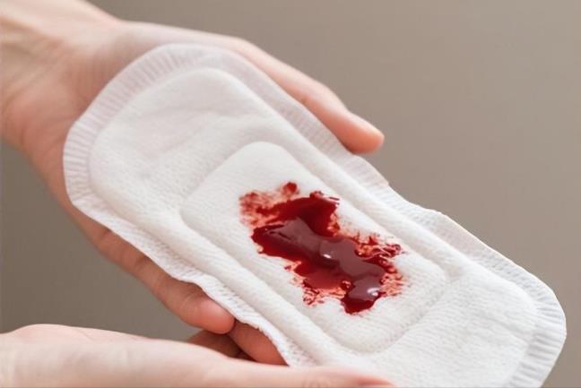 3 bat thuong trong ky kinh nguyet, co the la dau hieu cua u xo tu cung