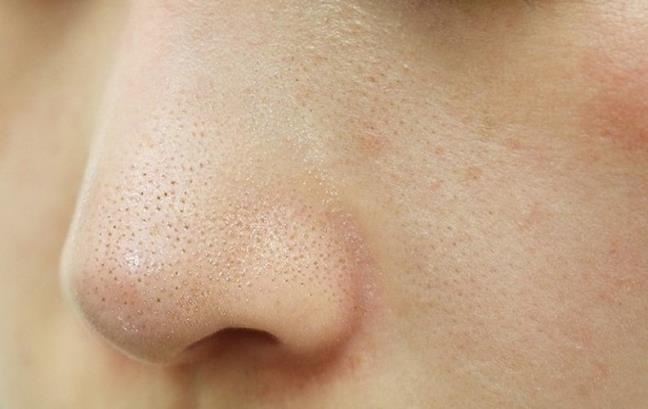 Da kho va nhay cam, co the lop mang bao ve da da bi ton thuong