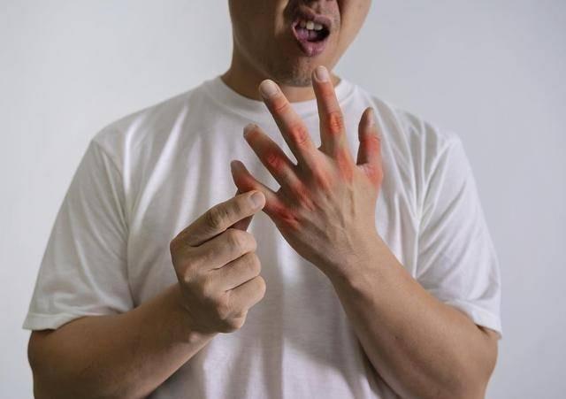 Khong phai hai san hay bia, day moi chinh la 4 thu pham gay Gut