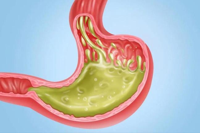 Thuong xuyen thay vi dang trong mieng co the mac phai 5 benh ly tiem an