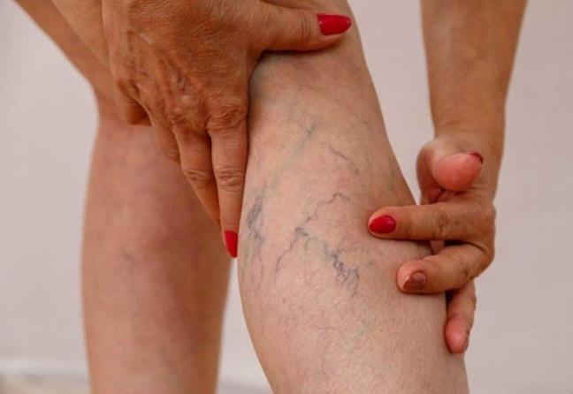 Chung gian tinh mach khong tu nhien xuat hien, chu yeu la do 4 nguyen nhan nay