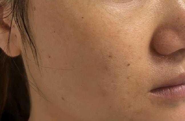 5 dau hieu cho thay khi huyet cua phu nu dang suy yeu