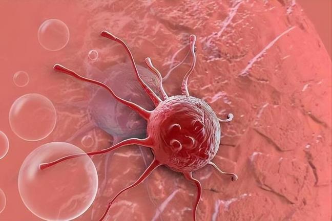 4 loai ung thu nay tien trien voi toc do dang bao dong, cach de phat hien som