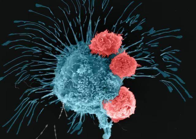 Neu 5 trieu chung nay van tiep dien, rat co the do la khoi u ac tinh; tot nhat la nen di kham