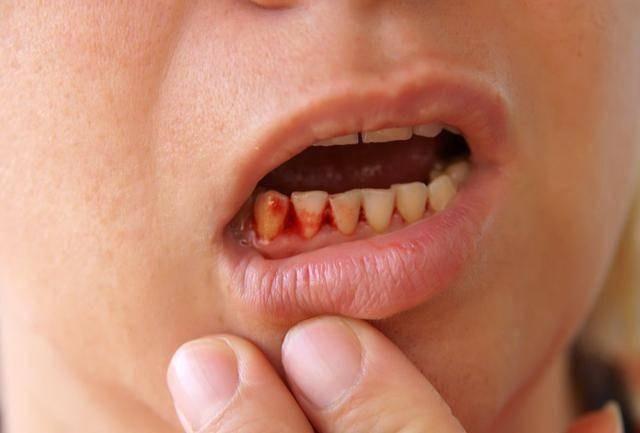 Neu 5 trieu chung nay van tiep dien, rat co the do la khoi u ac tinh; tot nhat la nen di kham