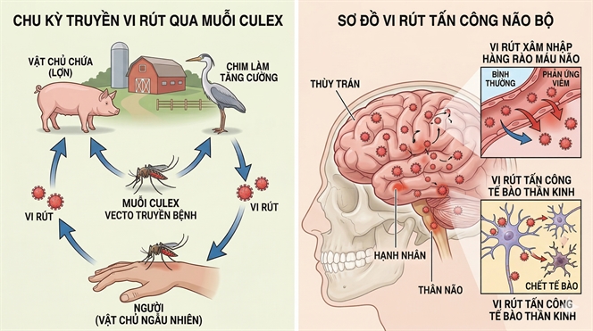 Viem nao Nhat Ban vao mua, me can nam ro 3 dau hieu nay de cuu nao bo cua con