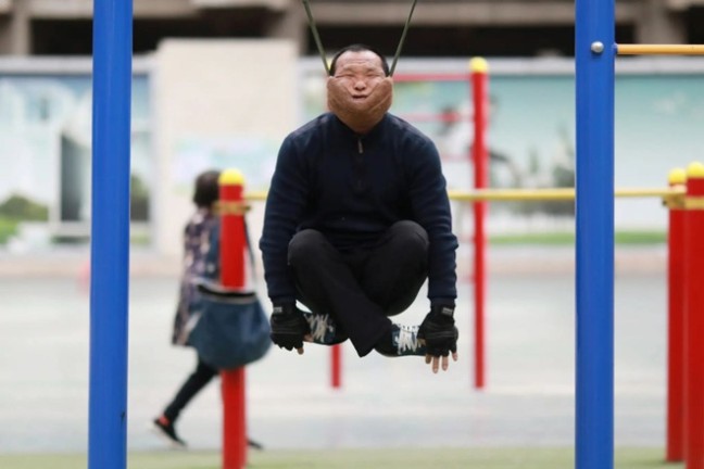 Canh bao hiem hoa liet toan than tu trao luu “Treo co” chua benh!