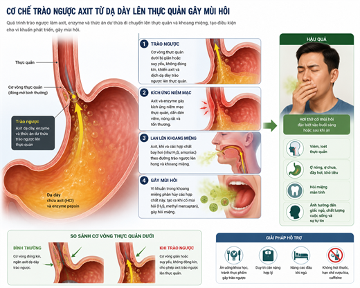 Mùi hơi thở buổi sáng: 3 dấu hiệu cảnh báo viêm nhiễm dạ dày và hệ hô hấp Mui hoi tho buoi sang: 3 dau hieu canh bao viem nhiem da day va he ho hap