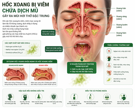 Mùi hơi thở buổi sáng: 3 dấu hiệu cảnh báo viêm nhiễm dạ dày và hệ hô hấp Mui hoi tho buoi sang: 3 dau hieu canh bao viem nhiem da day va he ho hap