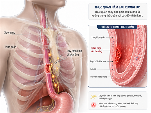 4 biểu hiện ở thực quản cảnh báo thói quen ăn đồ quá nóng, gây tổn thương niêm mạc 4 bieu hien o thuc quan canh bao thoi quen an do qua nong, gay ton thuong niem mac