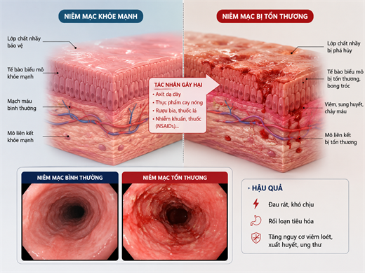 4 biểu hiện ở thực quản cảnh báo thói quen ăn đồ quá nóng, gây tổn thương niêm mạc 4 bieu hien o thuc quan canh bao thoi quen an do qua nong, gay ton thuong niem mac