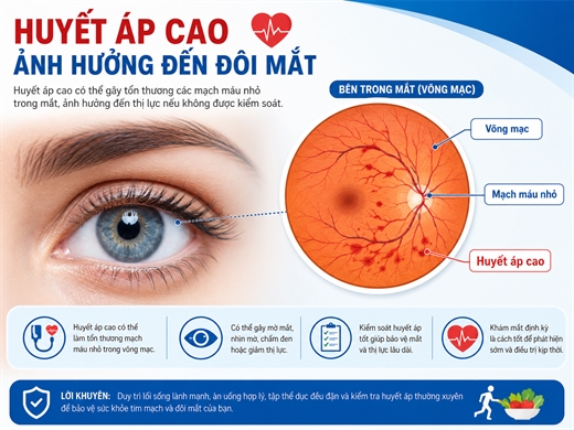 7 dau hieu canh bao huyet ap dang am tham mat kiem soat, tuyet doi khong lo la