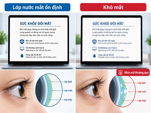 Buoc vao mua am uong, chu y 5 dau hieu mat kho qua muc de cap am kip thoi
