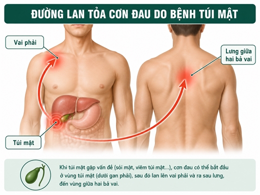  5 dau hieu tui mat co van de thuong xuat hien sau bua an nhieu dau mo