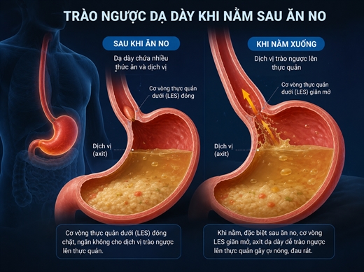 Tai sao trao nguoc da day lai 
