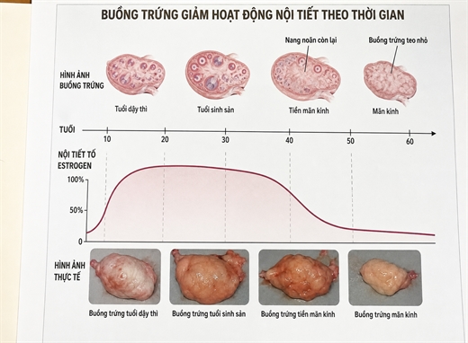 Chua gia da boc hoa, mat ngu: 5 dau hieu tien man kinh ap den som hon ban tuong